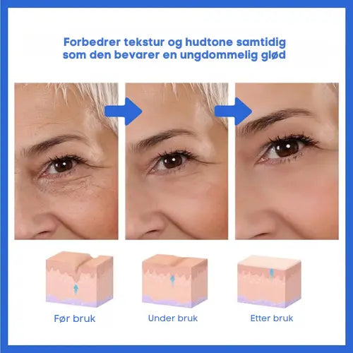 Botox Ansiktsserum AuroraNorge