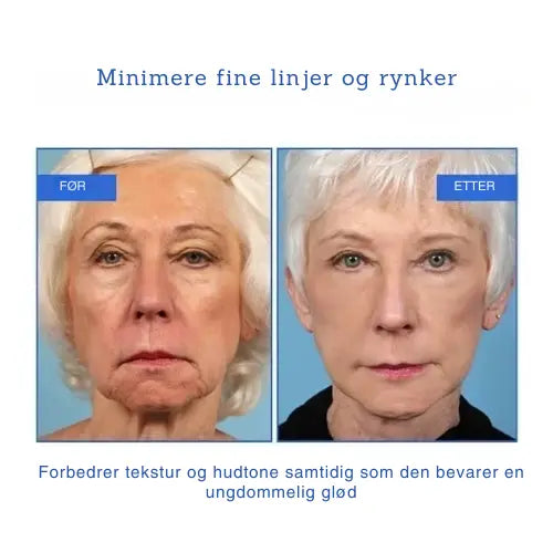 Botox Ansiktsserum AuroraNorge